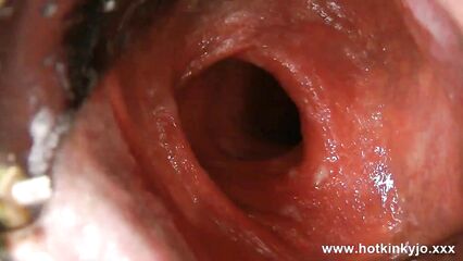 Анальный расширитель и мастурбация анала